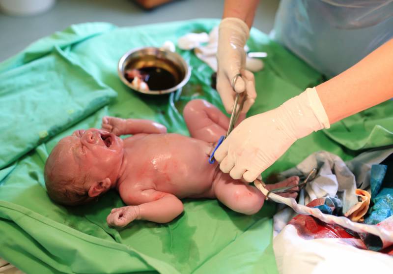 15_things_you_wish_you_knew_before_a_c_section_doctos_cuts_umbilical_cord_babyinfo