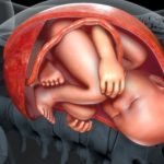 Anterior Placenta: Your Basic Questions Answered