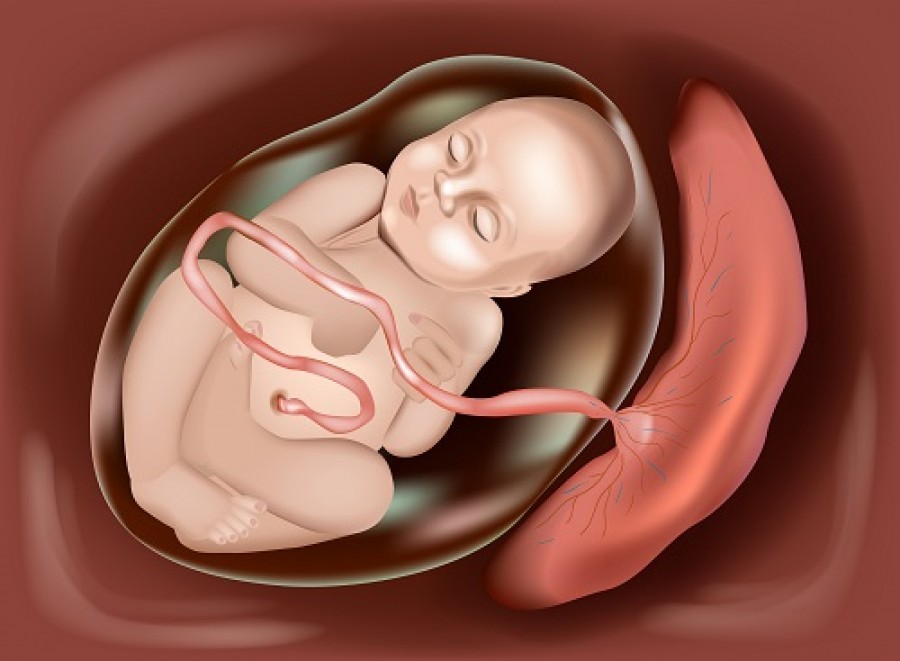 Placenta Accreta: Facts You Need To Know