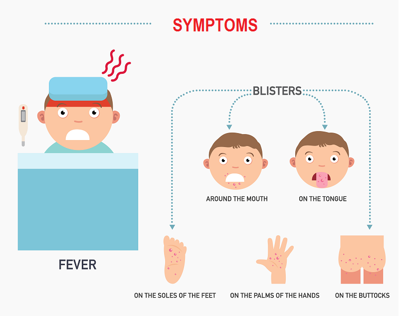 SYMPTOMS - hand food and mouth disease babyinfo_a_1556958085