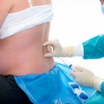 Things to Know Before Thinking About an Epidural