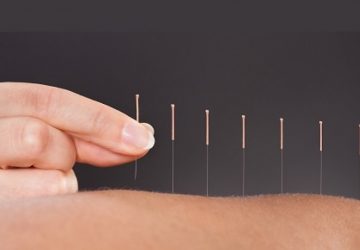 What You Need to Know About Acupuncture for Fertility