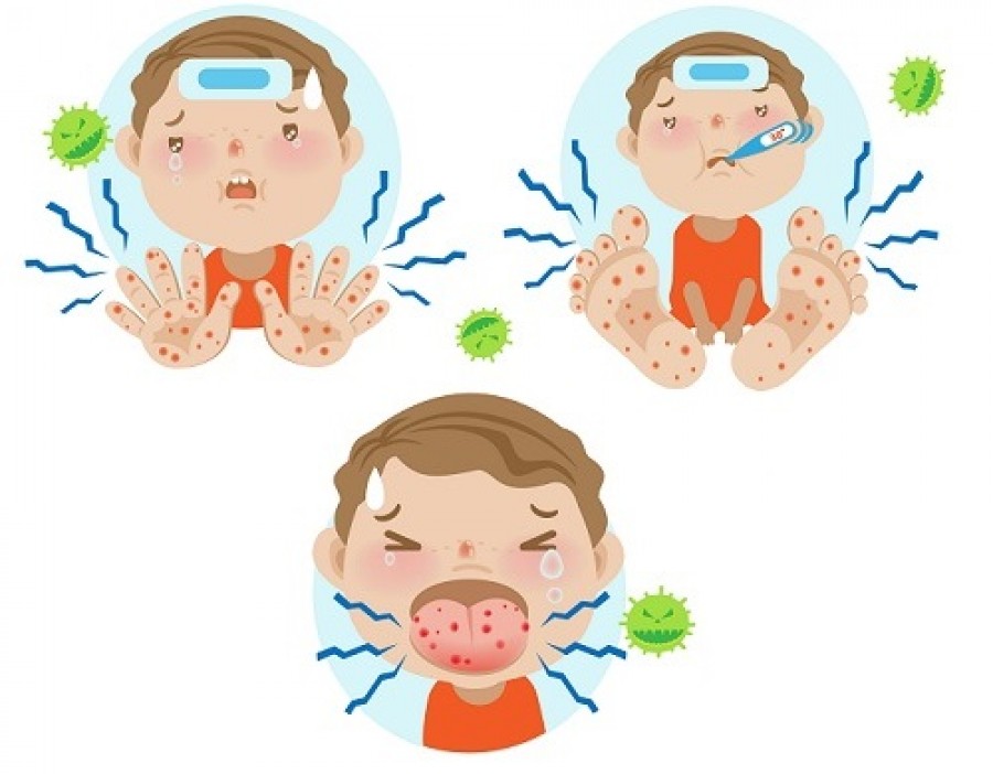 Understanding Hand, Foot and Mouth Disease