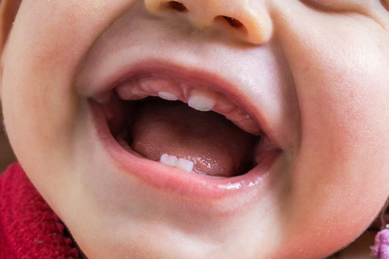 baby's_first_trip_to_the_dentist_mouth_closeup_babyinfo