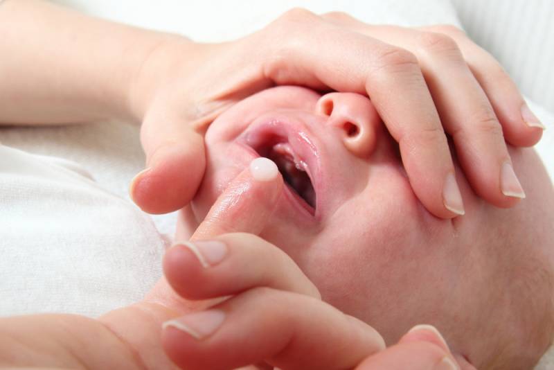 oral_thrush_in_babies_treatment_babyinfo_a_1556725214