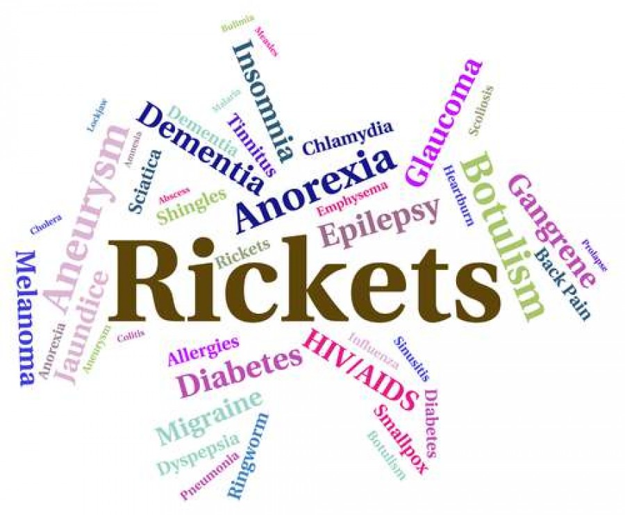 Rickets: Causes, Diagnosis and Management