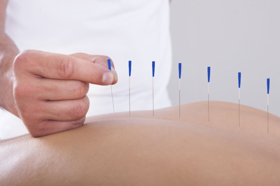 Adriana Bellicanta Acupuncture