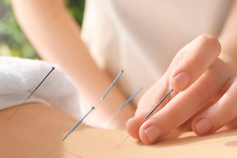 8 Best Fertility Acupuncturists in Canberra
