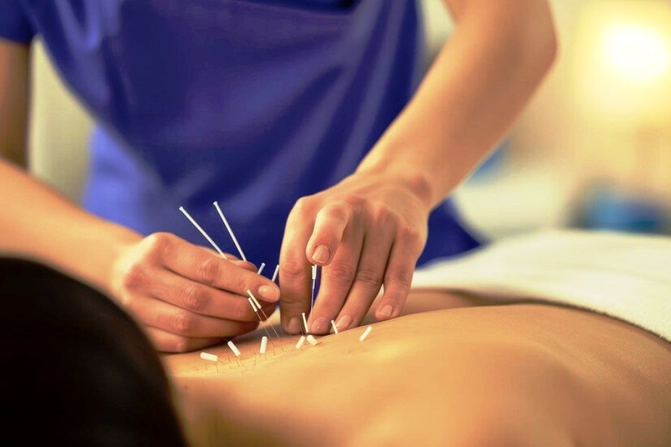 8 Best Fertility Acupuncturists in Hobart