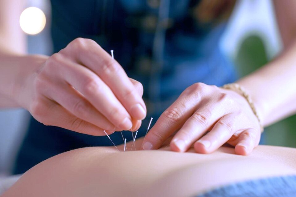 10 Best Fertility Acupuncturists in Melbourne
