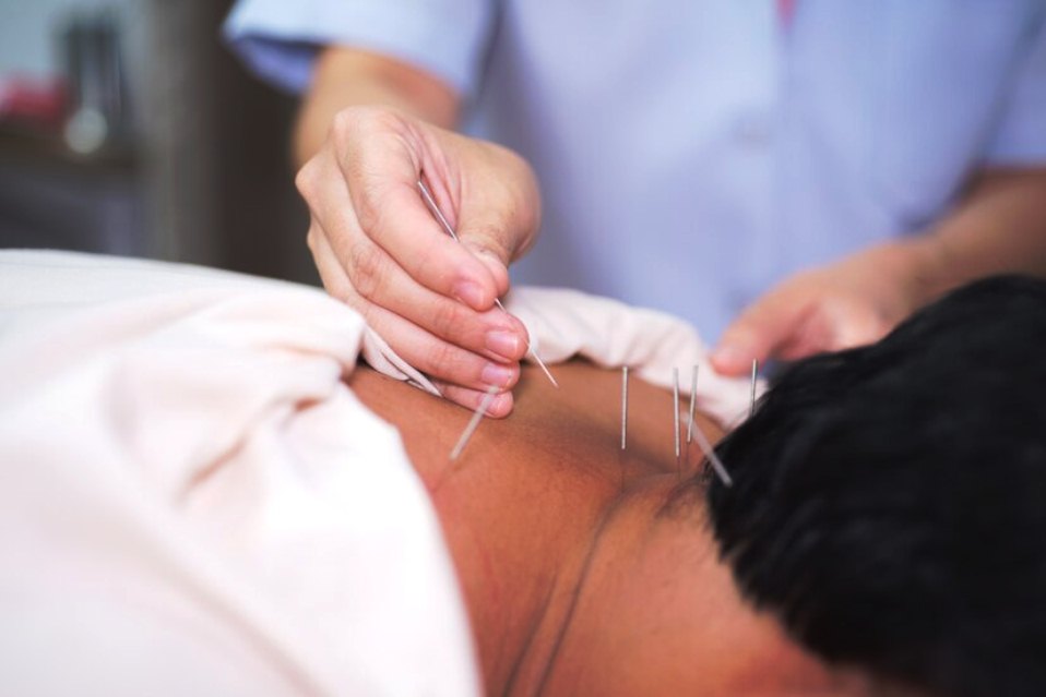 4 Best Fertility Acupuncturists in Newcastle