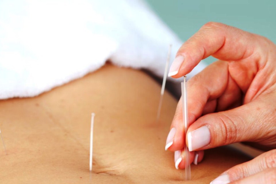 5 Best Fertility Acupuncturists in Wollongong